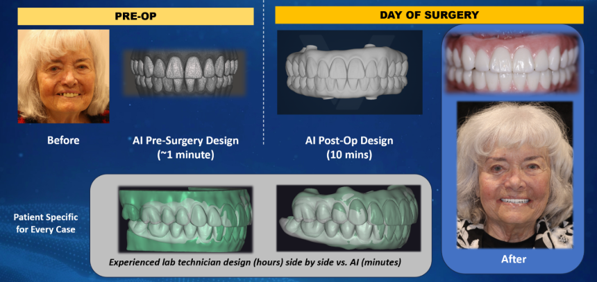 Figure 4 All-on-X fully automated AI proposal by Voyager Dental